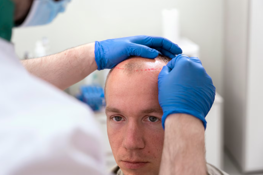 hair restoration surgery